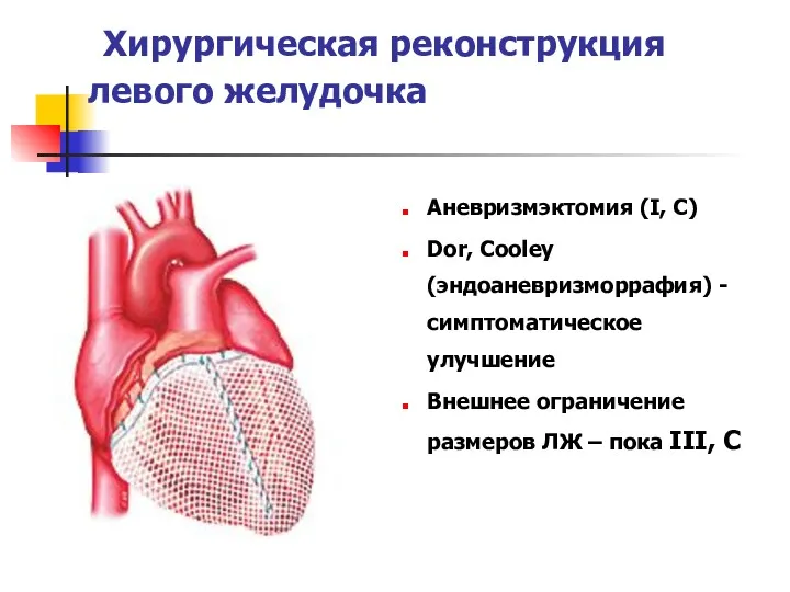 Хирургическая реконструкция левого желудочка Аневризмэктомия (I, C) Dor, Cooley (эндоаневризморрафия)