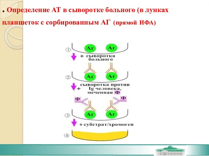 . Определение АТ в сыворотке больного (в лунках планшеток с сорбированным АГ (прямой ИФА)