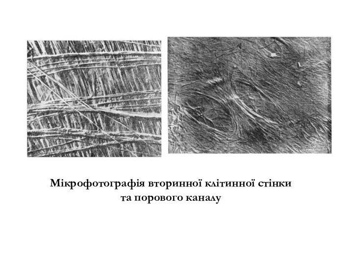 Мікрофотографія вторинної клітинної стінки та порового каналу