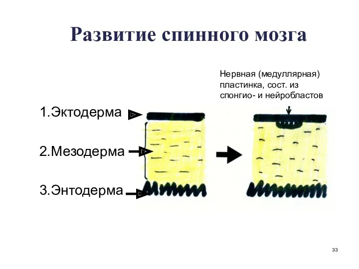 Развитие спинного мозга 1.Эктодерма 2.Мезодерма 3.Энтодерма Нервная (медуллярная) пластинка, сост. из спонгио- и нейробластов