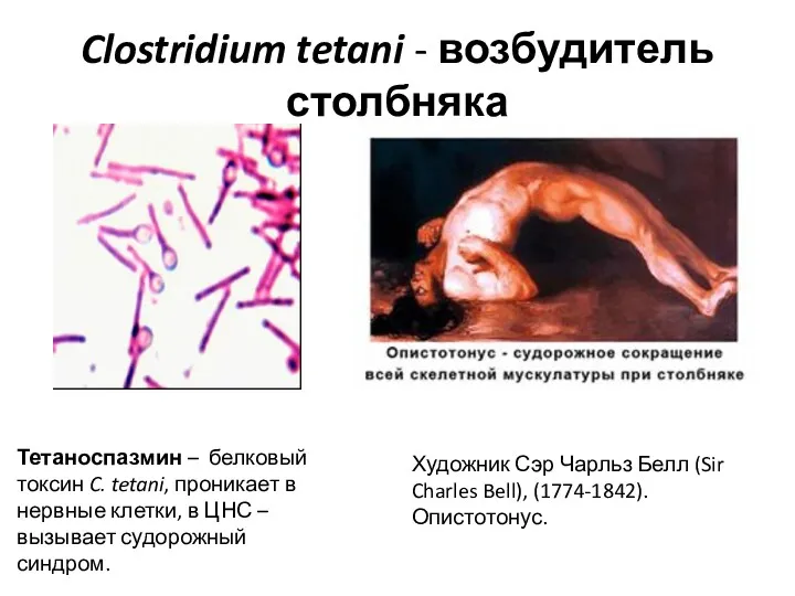 Clostridium tetani - возбудитель столбняка Художник Сэр Чарльз Белл (Sir