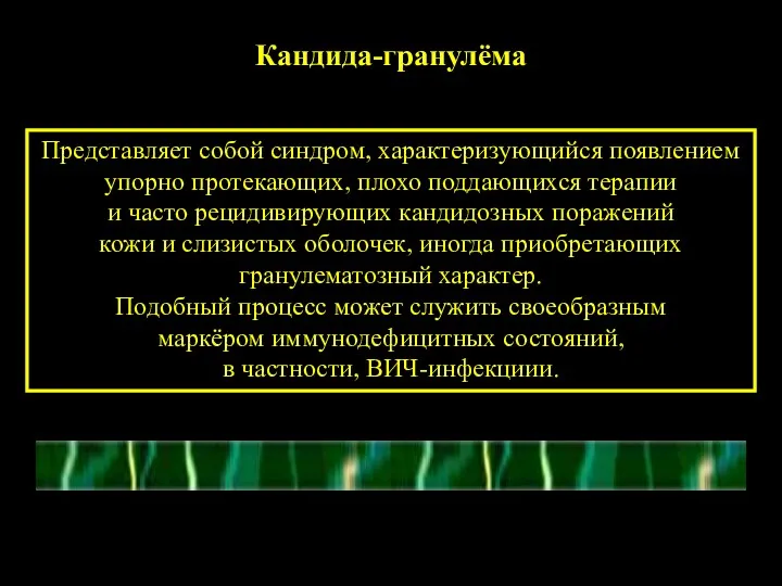 Кандида-гранулёма Представляет собой синдром, характеризующийся появлением упорно протекающих, плохо поддающихся