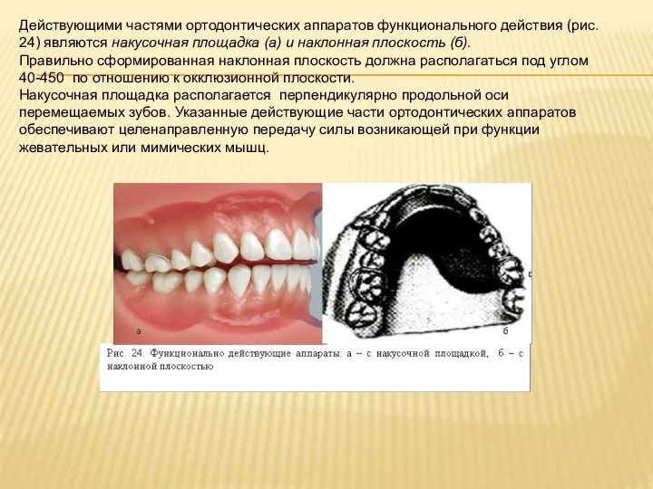 Действующими частями ортодонтических аппаратов функционального действия (рис. 24) являются накусочная
