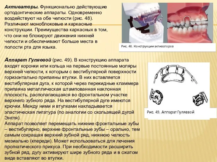 Активаторы. Функционально действующие ортодонтические аппараты. Одновременно воздействуют на обе челюсти