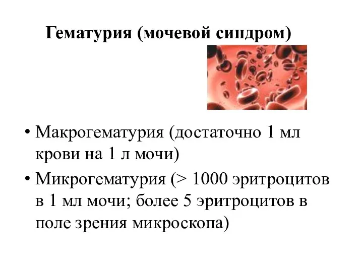 Гематурия (мочевой синдром) Макрогематурия (достаточно 1 мл крови на 1