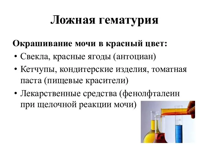 Ложная гематурия Окрашивание мочи в красный цвет: Свекла, красные ягоды