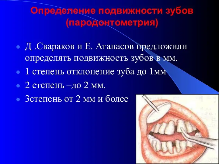 Определение подвижности зубов (пародонтометрия) Д .Свараков и Е. Атанасов предложили