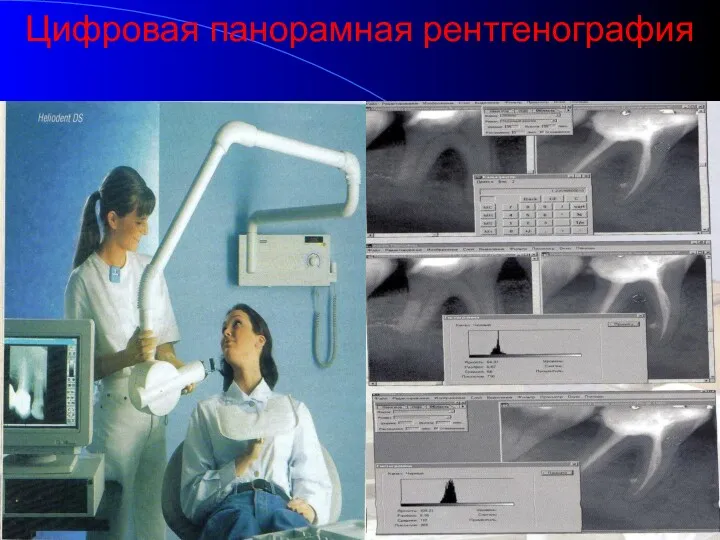 Цифровая панорамная рентгенография