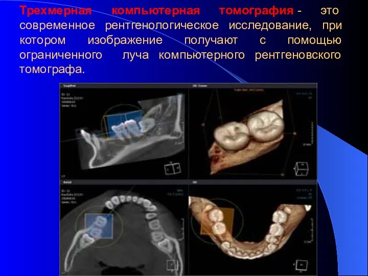 Трехмерная компьютерная томография - это современное рентгенологическое исследование, при котором
