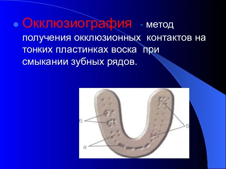 Окклюзиография - метод получения окклюзионных контактов на тонких пластинках воска при смыкании зубных рядов.