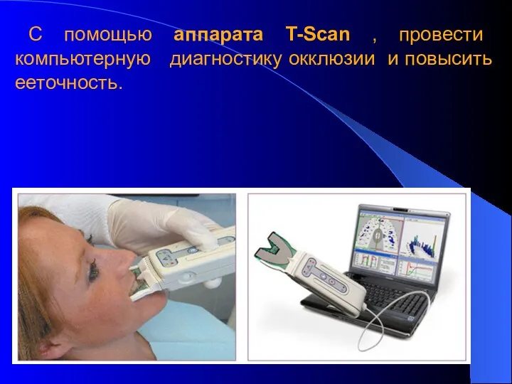 С помощью аппарата T-Scan , провести компьютерную диагностику окклюзии и повысить ееточность.