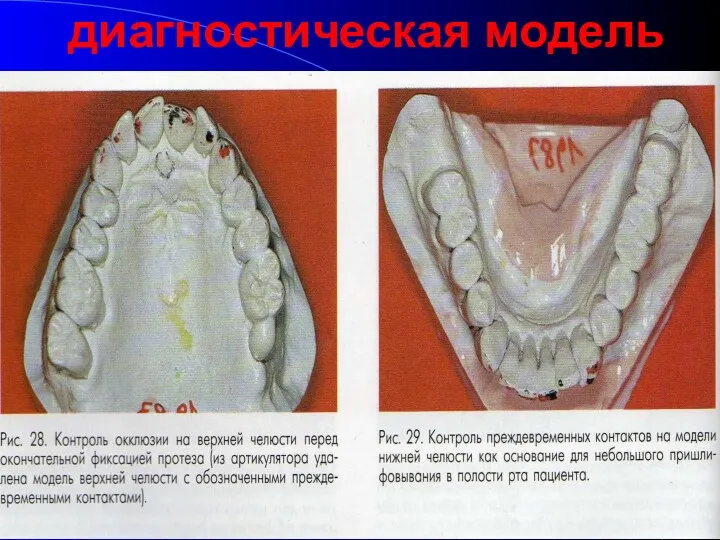 диагностическая модель