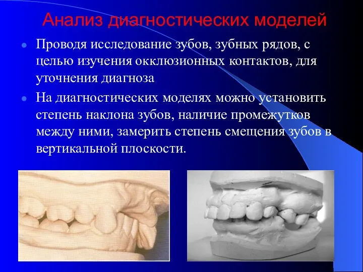 Анализ диагностических моделей Проводя исследование зубов, зубных рядов, с целью