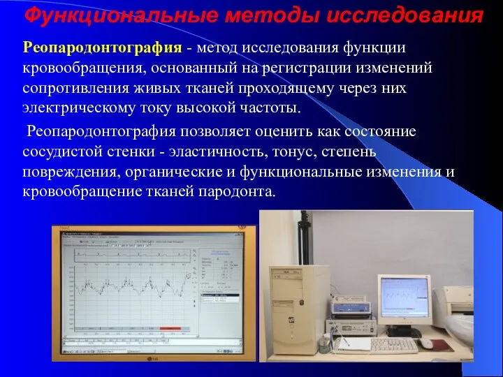 Функциональные методы исследования Реопародонтография - метод исследования функции кровообращения, основанный