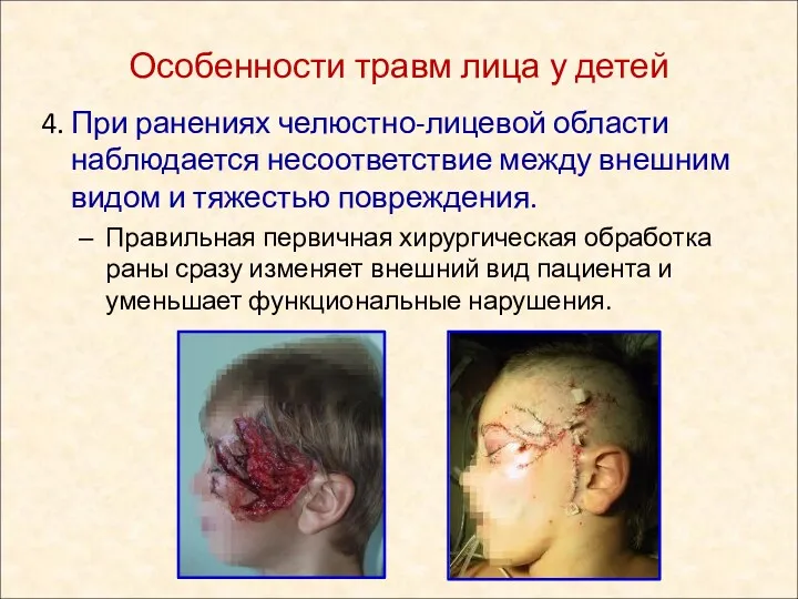 4. При ранениях челюстно-лицевой области наблюдается несоответствие между внешним видом