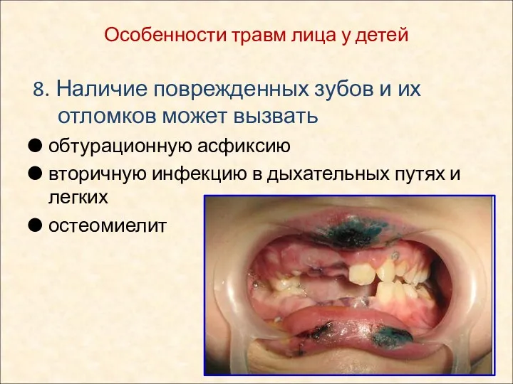 8. Наличие поврежденных зубов и их отломков может вызвать обтурационную