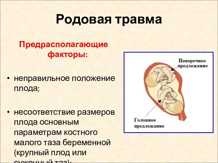 Родовая травма Предрасполагающие факторы: неправильное положение плода; несоответствие размеров плода