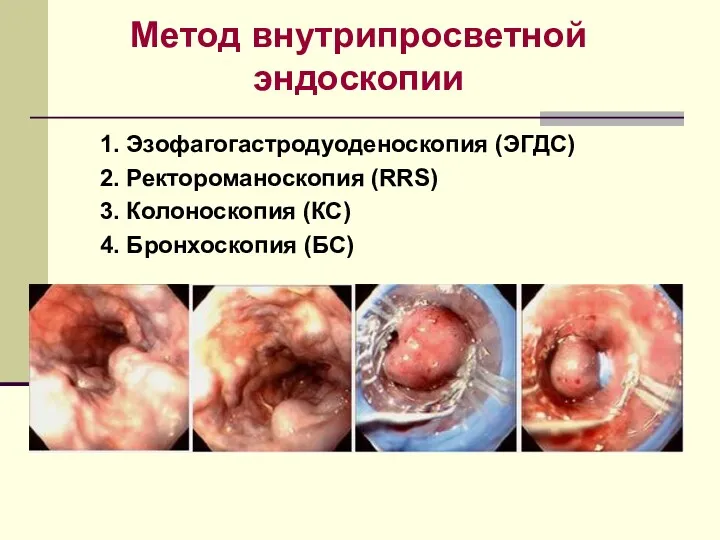 Метод внутрипросветной эндоскопии 1. Эзофагогастродуоденоскопия (ЭГДС) 2. Ректороманоскопия (RRS) 3. Колоноскопия (КС) 4. Бронхоскопия (БС)