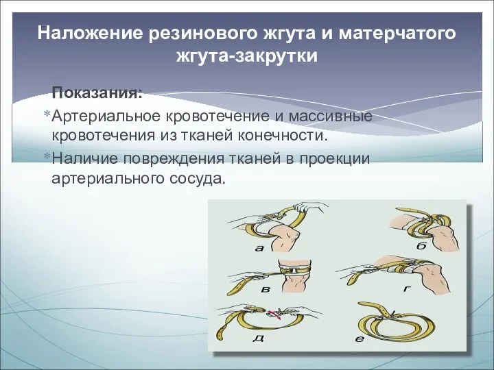 Показания: Артериальное кровотечение и массивные кровотечения из тканей конечности. Наличие