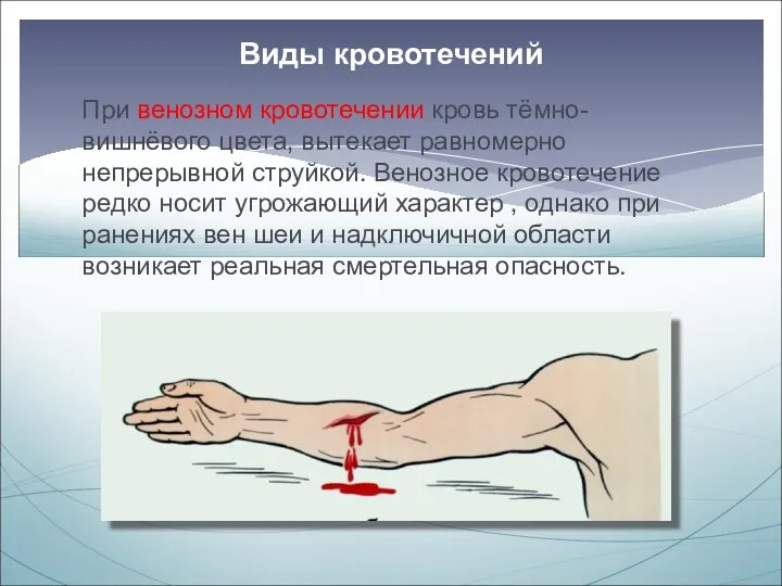 При венозном кровотечении кровь тёмно-вишнёвого цвета, вытекает равномерно непрерывной струйкой.