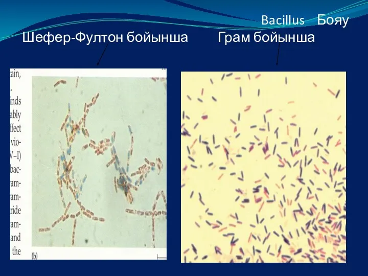 Bacillus Бояу Шефер-Фултон бойынша Грам бойынша