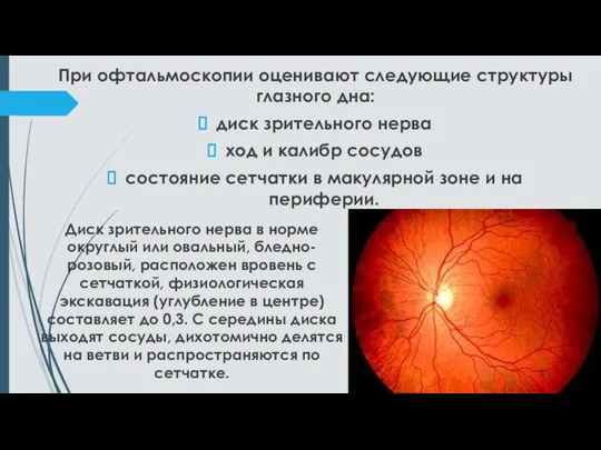 При офтальмоскопии оценивают следующие структуры глазного дна: диск зрительного нерва