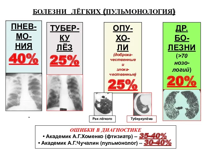 ОШИБКИ В ДИАГНОСТИКЕ Академик А.Г.Хоменко (фтизиатр) – 35-40% Академик А.Г.Чучалин