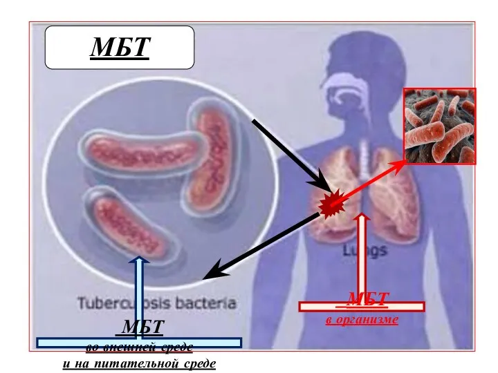 МБТ в организме МБТ МБТ во внешней среде и на питательной среде