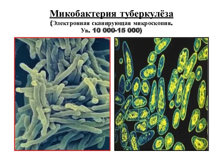 Микобактерия туберкулёза (Электронная сканирующая микроскопия. Ув. 10 000-15 000)