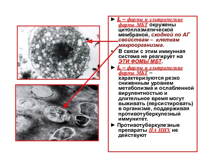 ► L – формы и ультромелкие формы МБТ окружены цитоплазматической