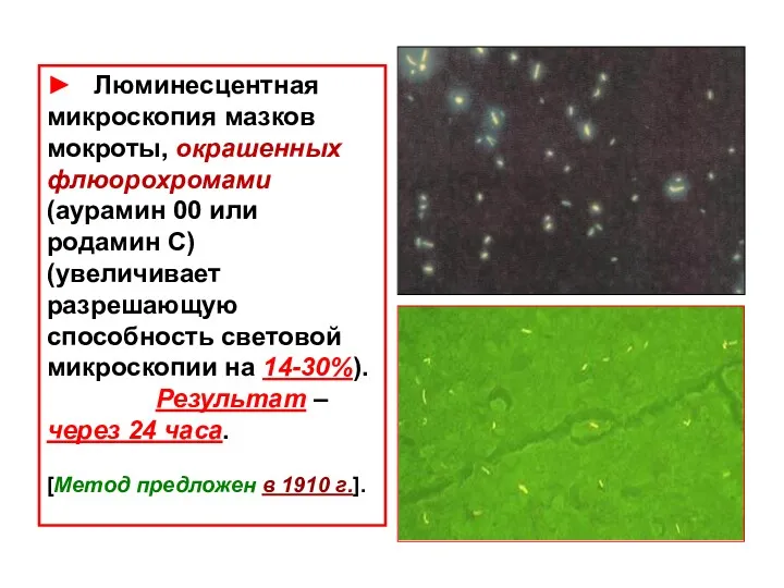 ► Люминесцентная микроскопия мазков мокроты, окрашенных флюорохромами (аурамин 00 или