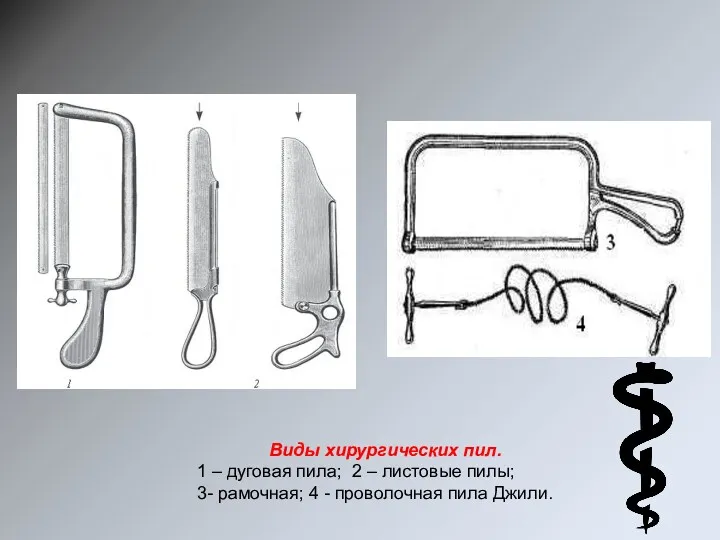 Виды хирургических пил. 1 – дуговая пила; 2 – листовые