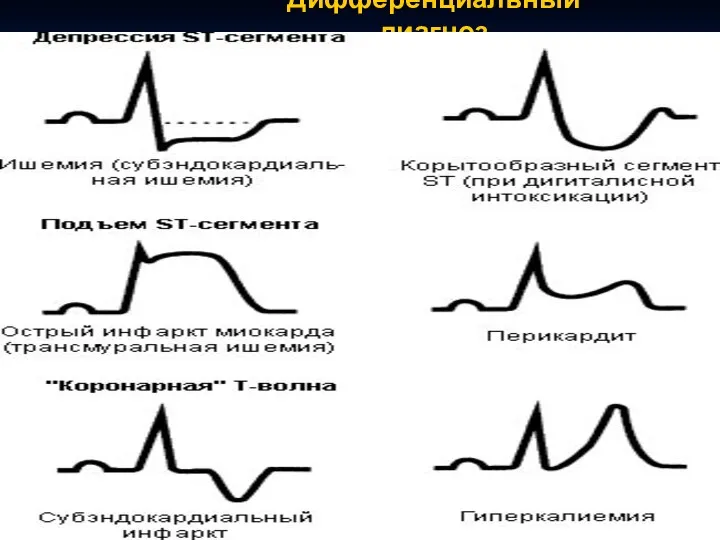 Дифференциальный диагноз КЛ