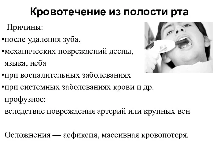 Кровотечение из полости рта Причины: после удаления зуба, механических повреждений