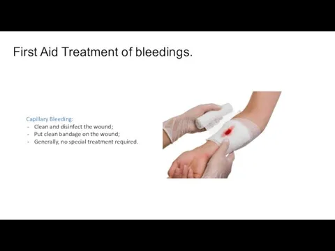 First Aid Treatment of bleedings. Capillary Bleeding: Clean and disinfect
