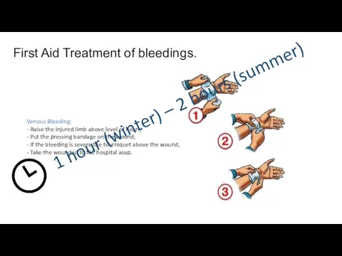 First Aid Treatment of bleedings. Venous Bleeding: - Raise the