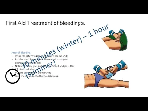 First Aid Treatment of bleedings. Arterial Bleeding: Press the artery