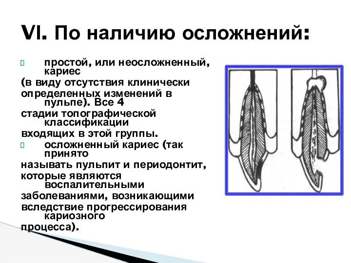 простой, или неосложненный, кариес (в виду отсутствия клинически определенных изменений