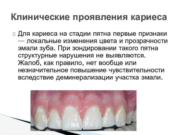 Для кариеса на стадии пятна первые признаки — локальные изменения