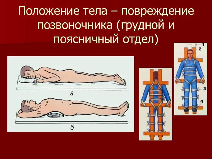 Положение тела – повреждение позвоночника (грудной и поясничный отдел)