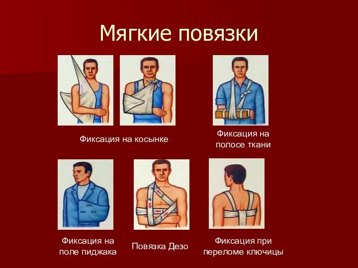 Мягкие повязки