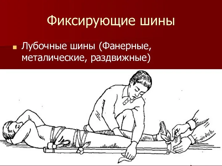 Фиксирующие шины Лубочные шины (Фанерные, металические, раздвижные)