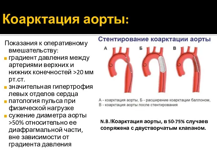 Коарктация аорты: Показания к оперативному вмешательству: градиент давления между артериями