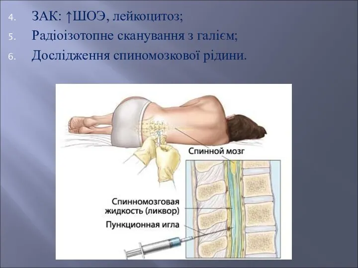 ЗАК: ↑ШОЭ, лейкоцитоз; Радіоізотопне сканування з галієм; Дослідження спиномозкової рідини.