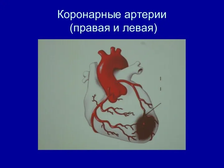 Коронарные артерии (правая и левая)
