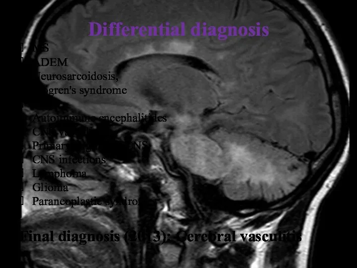 Differential diagnosis MS ADEM Neurosarcoidosis, Sjögren's syndrome NMO Autoimmune encephalitides CNS vasculitis Primary