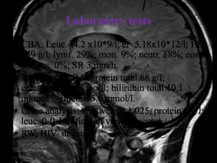 Laboratory tests CBA: Leuc.- 4.2 x10*9/l; er 5.18x10*12/l; Hb 159 g/l; lymf. 29%;