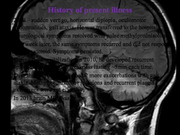 History of present illness 2010 – sudden vertigo, horizontal diplopia, oculomotor abnormalities, gait