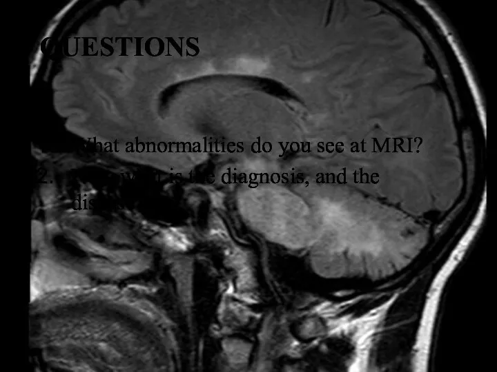 QUESTIONS What abnormalities do you see at MRI? Now what is the diagnosis, and the disease?