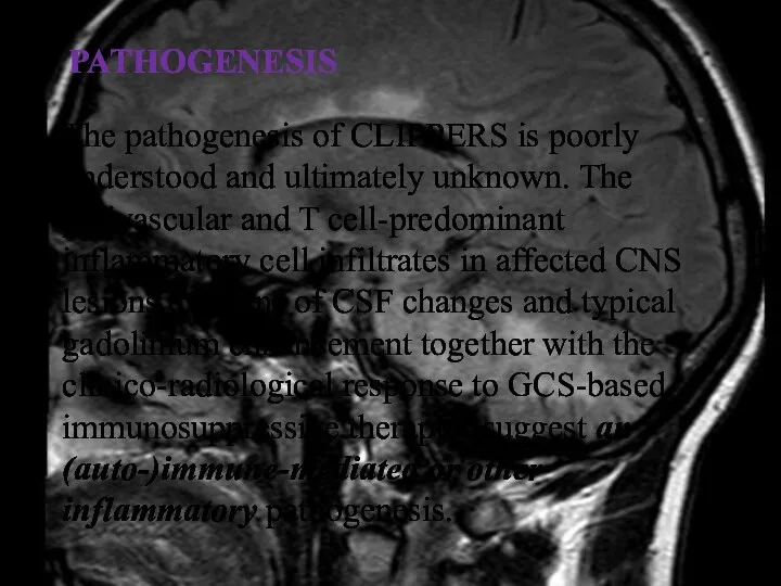 PATHOGENESIS The pathogenesis of CLIPPERS is poorly understood and ultimately unknown. The perivascular